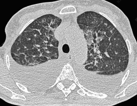 Why Are Failed CT Tests on Tour Hidden from the Public? What You Need to Know